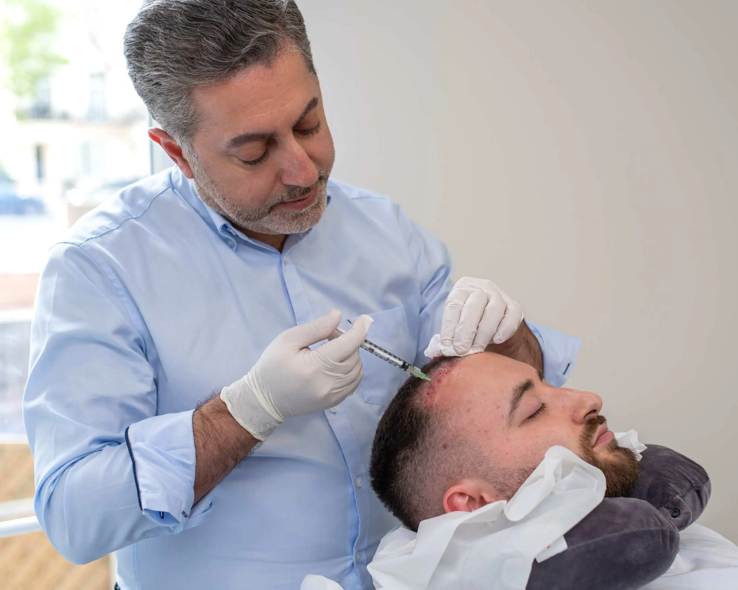 Best clinics for scalp micropigmentation in Lambeth, London