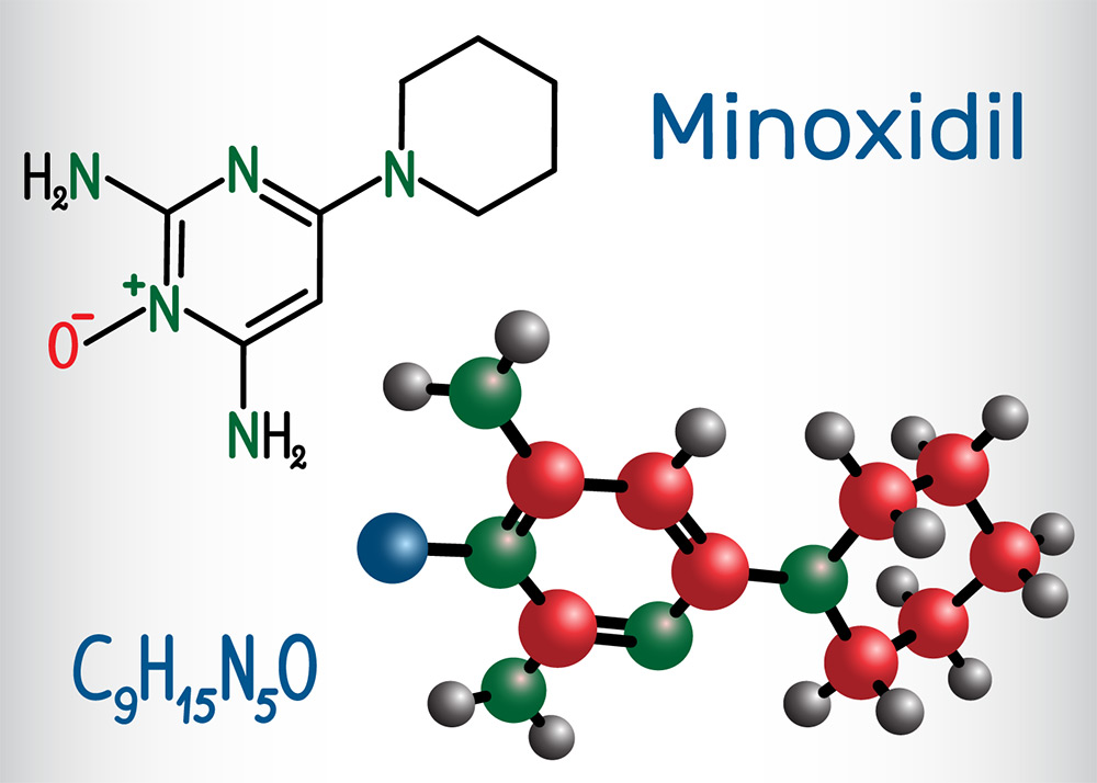 does minoxidil work, minoxidil hair growth, minoxidil for hair loss, hair loss medication