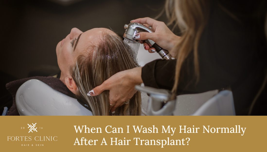 When Can I Wash My Hair Normally After A Hair Transplant?