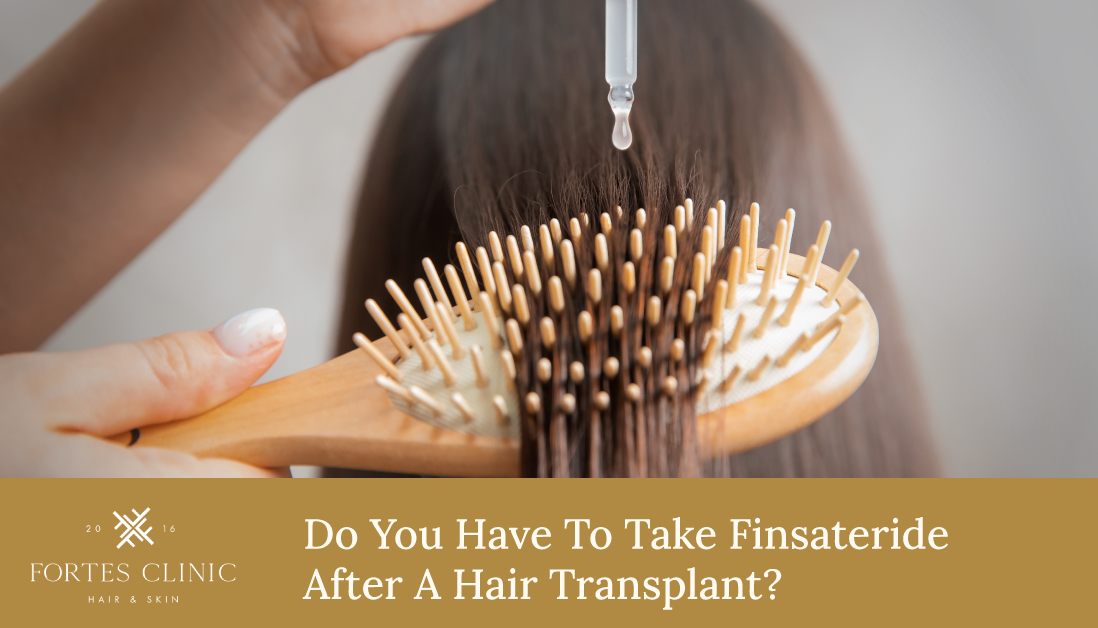 Do You Have To Take Finasteride After A Hair Transplant