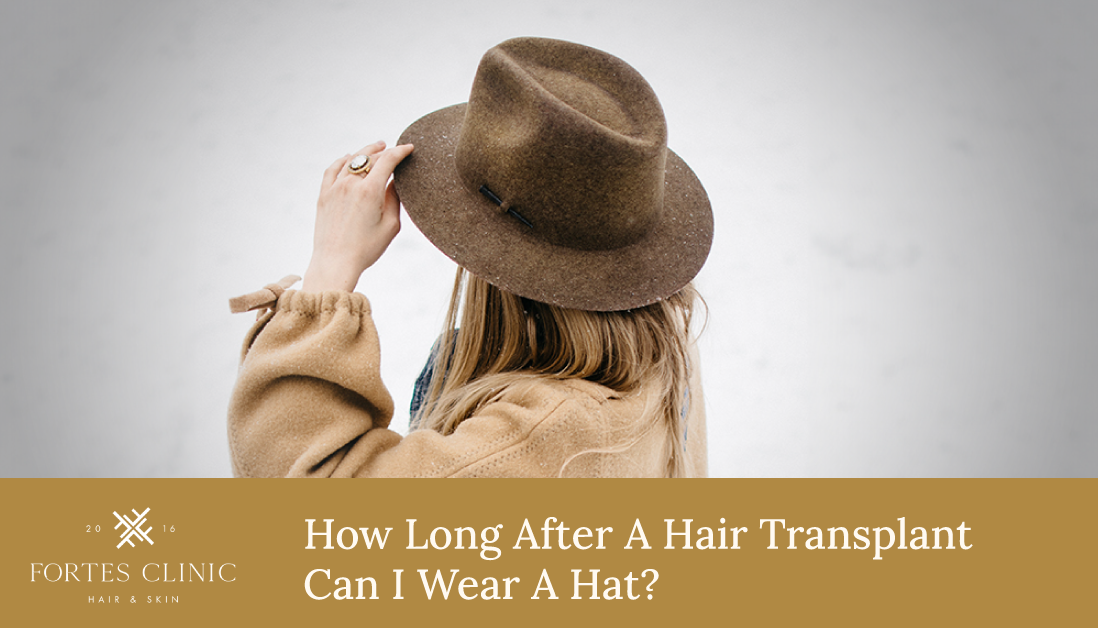 How Long After A Hair Transplant Can I Wear A Hat