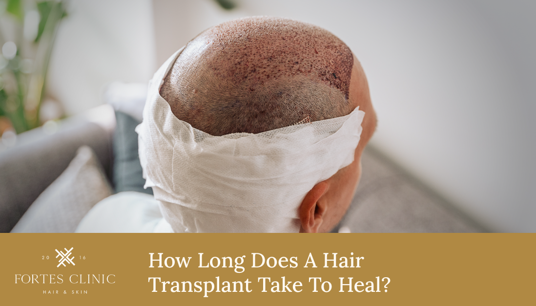 How Long Does A Hair Transplant Take To Heal?
