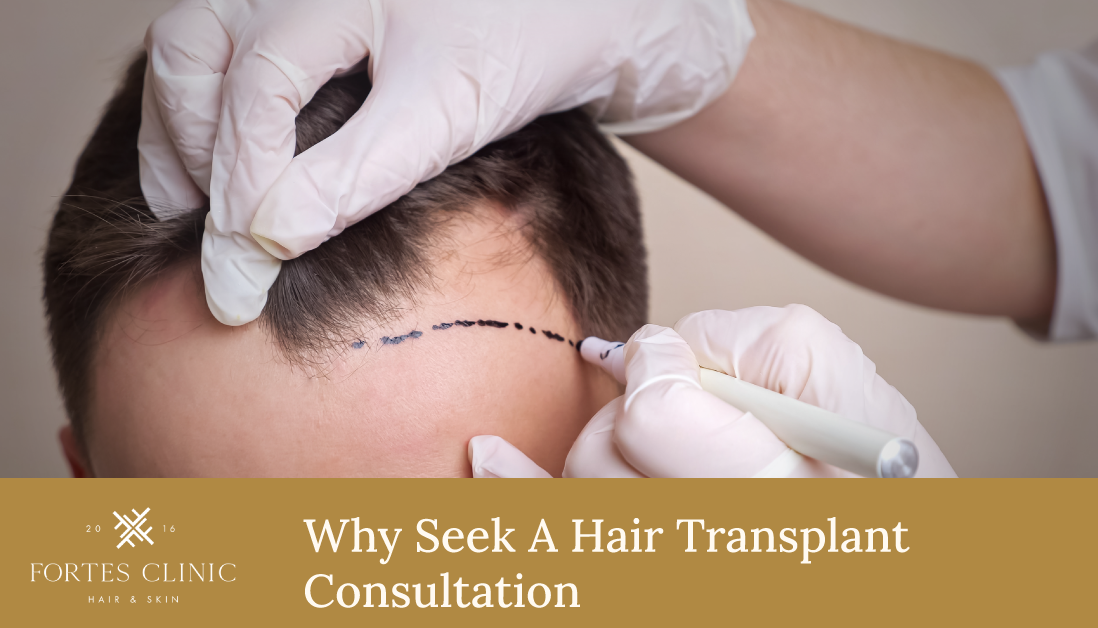 Hair Transplant Consultation