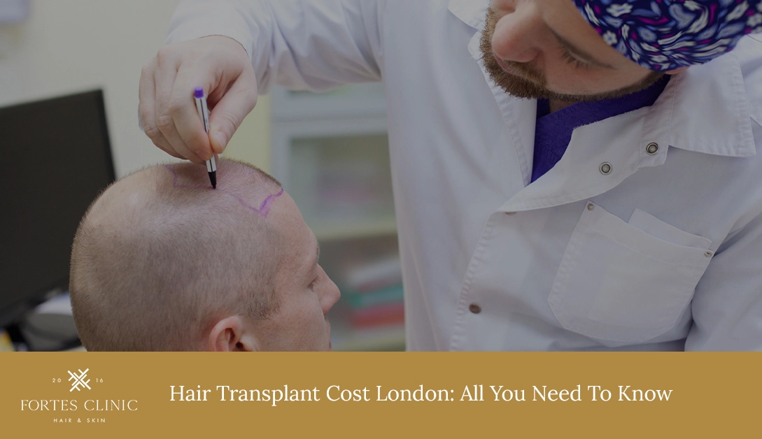 Hair Transplant Cost London