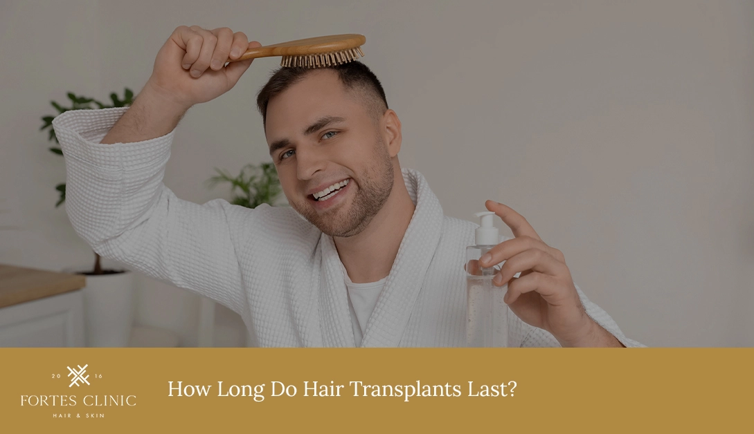 How Long Do Hair Transplants Last?