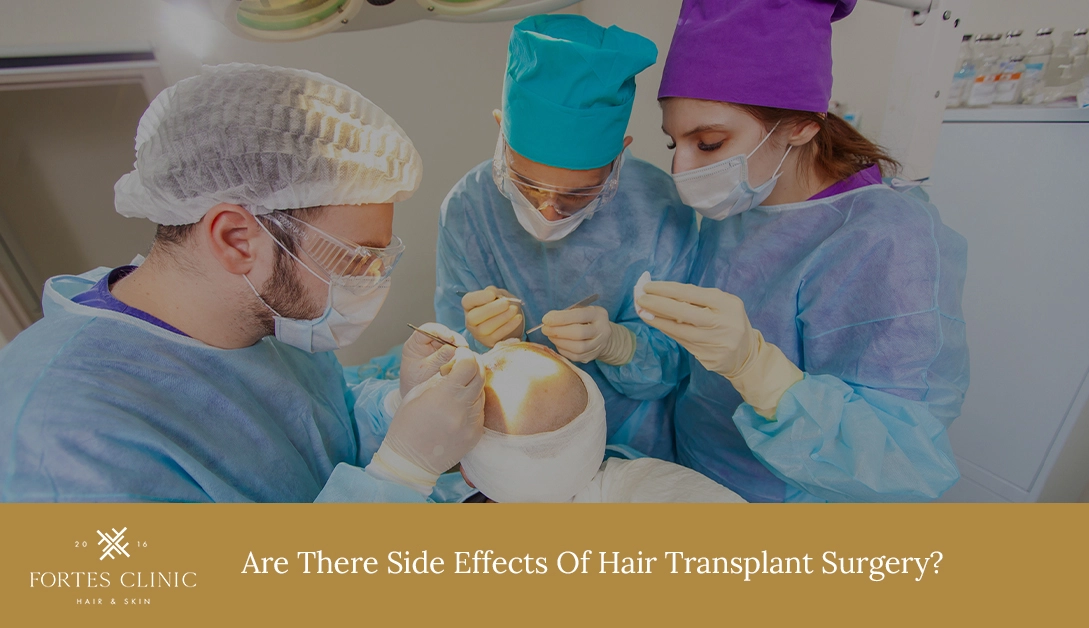 Side Effects of Hair Transplant