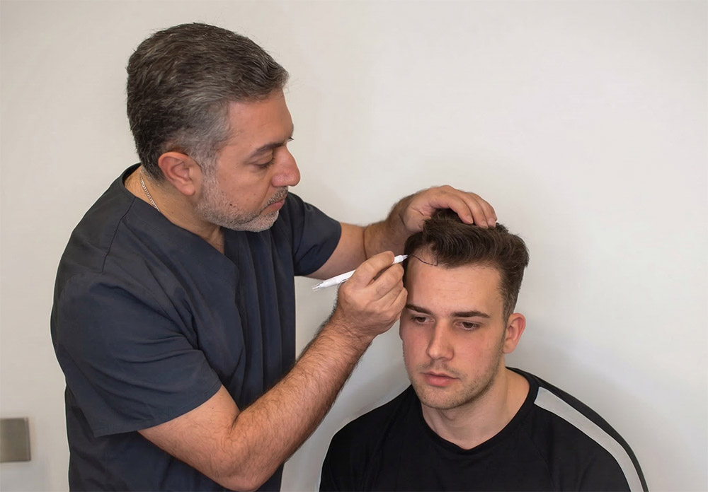 mature hairline vs receding, male pattern hair loss, hairline assessment, frontal hair thinning