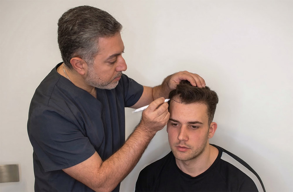early signs of male pattern baldness, tracking hair loss, hairline progression