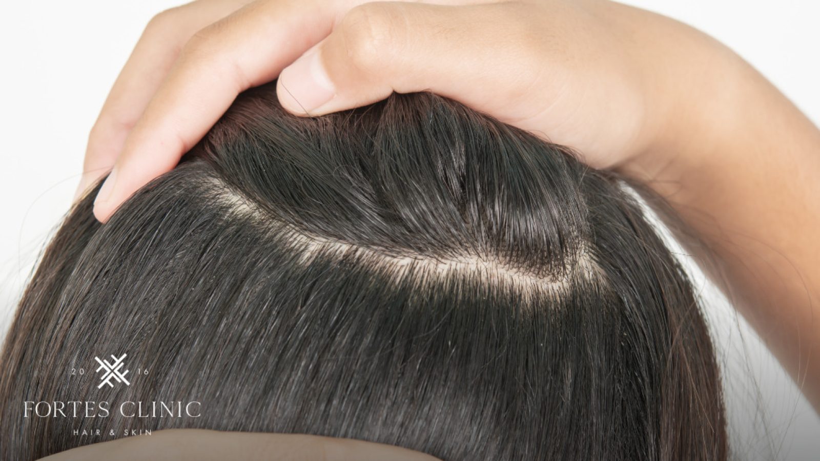 1642517_FortesClinicBlogImagery10_052223