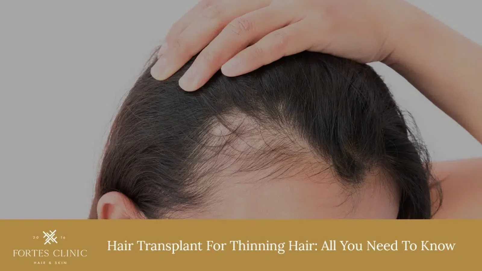 Hair-Transplant-For-Thinning-Hair_-All-You-Need-To-Know-1