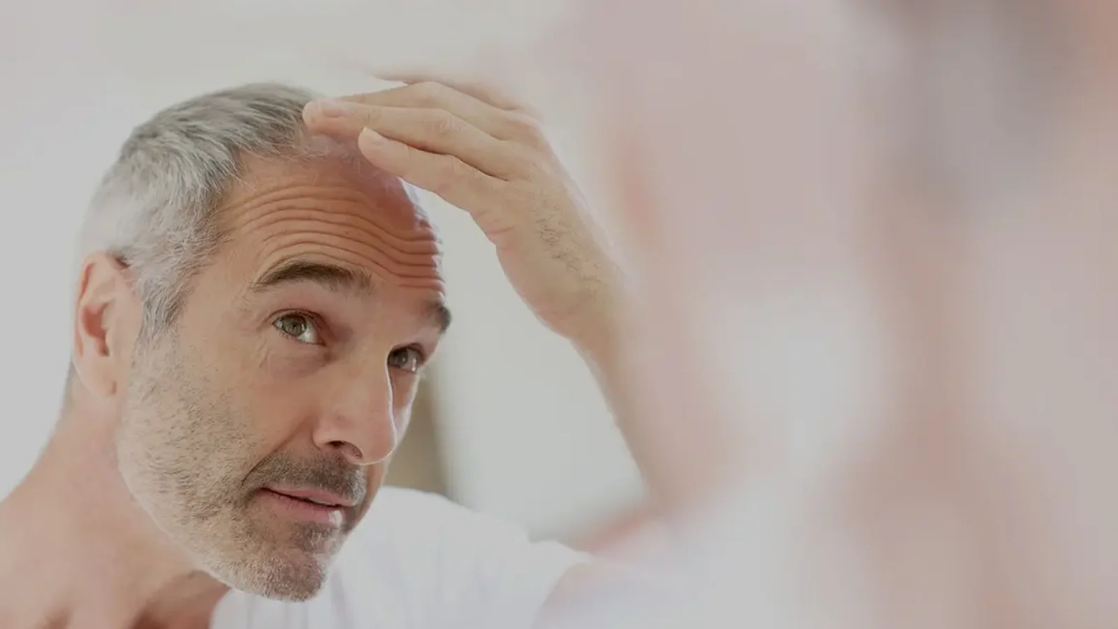Types of hair loss
